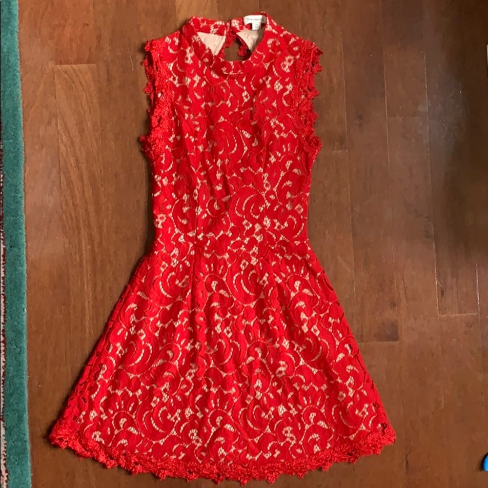 Francesca’s Lace Dress